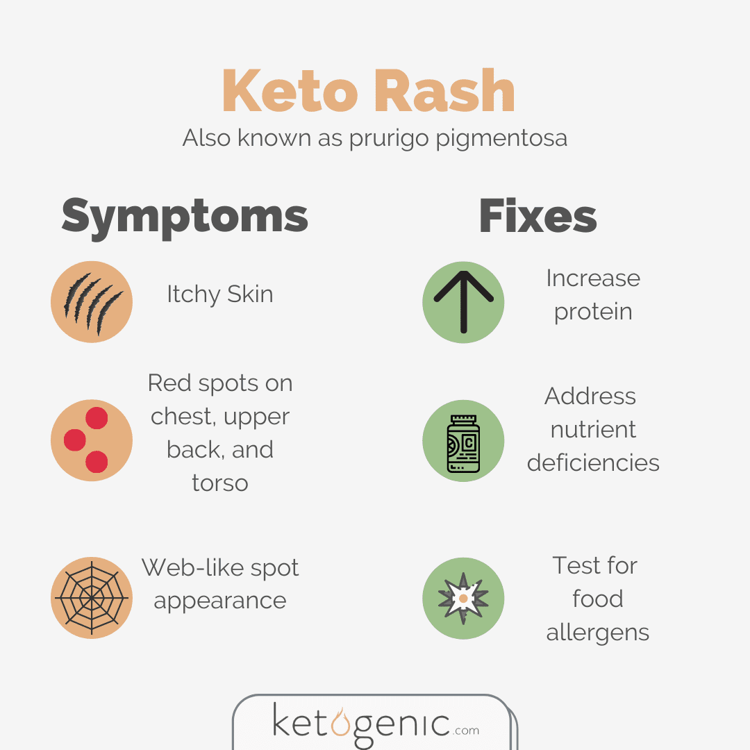 Keto Rash Clarification